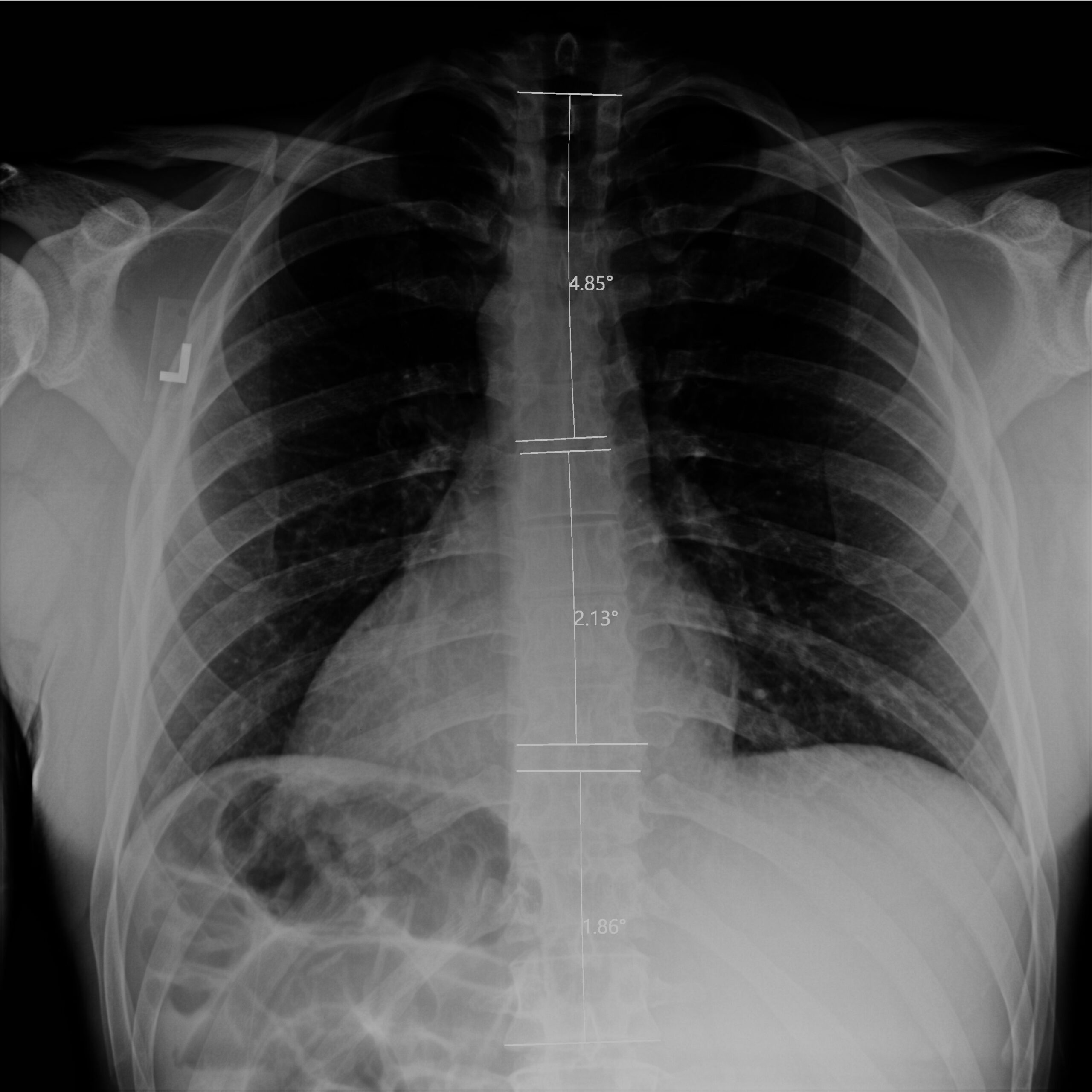 After_Dr Dean Peters LLC_CR_Anderson_Guse_TSpine