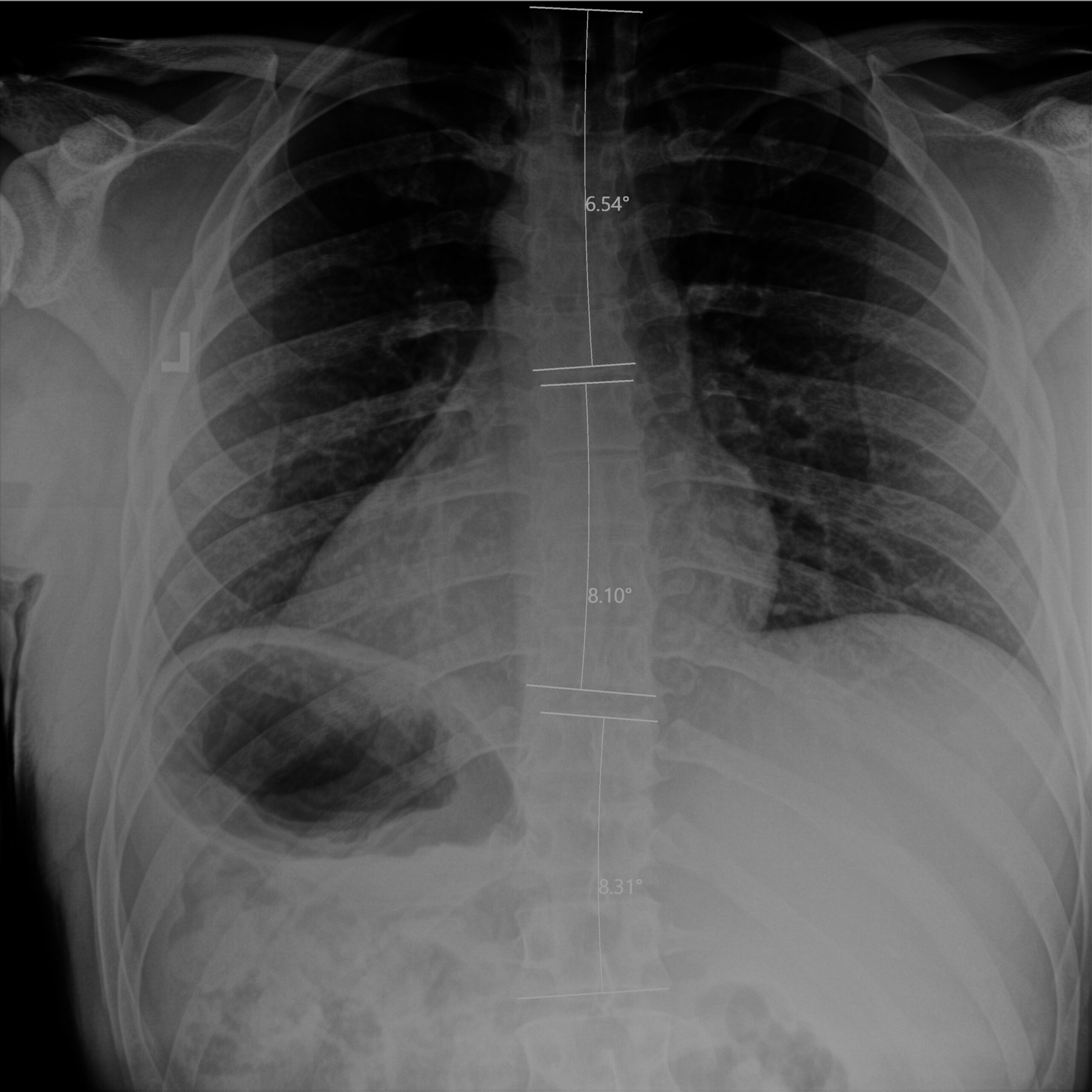 Before_Dr Dean Peters LLC_CR_Anderson_Guse_TSpine Before_Dr Dean Peters LLC_CR_Anderson_Guse_TSpine