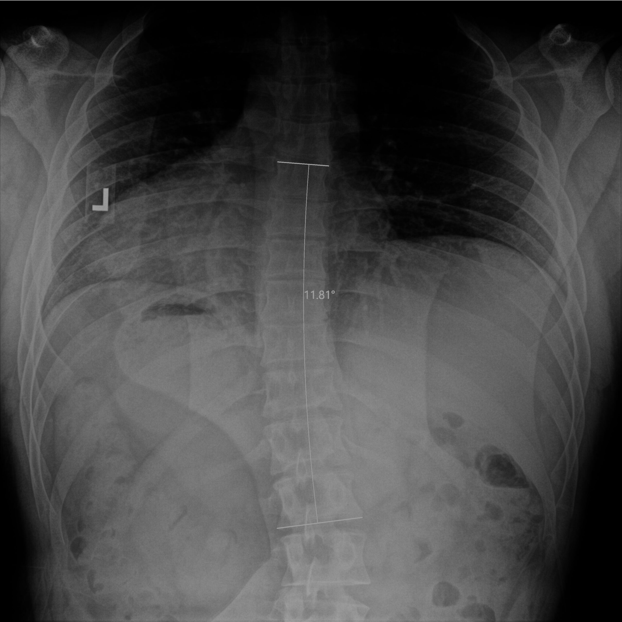 after_Dr Dean Peters LLC_CR_Thomas_Taranto_TSpine_AP_4-10-2026T4-53-20PM